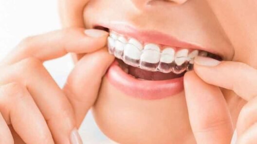 Is-Invisalign-Only-for-Minor-Teeth-Adjustments