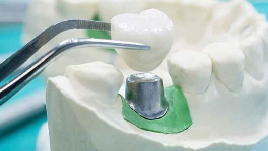 An Overview of the Major Types of Restorative Dentistry in Sugar Land