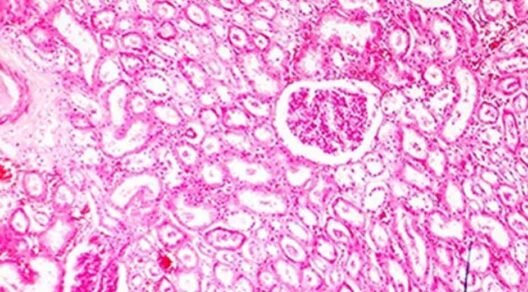 How-Immunohistochemistry-Is-FFPE-Sample-Tissue-Reliant