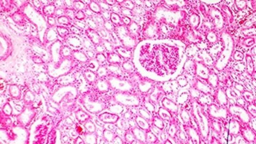 How-Immunohistochemistry-Is-FFPE-Sample-Tissue-Reliant