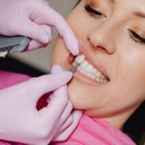 Step-by-Step Stages of Professional Veneer Treatment in Peabody