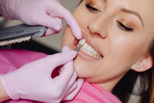 Step-by-Step Stages of Professional Veneer Treatment in Peabody