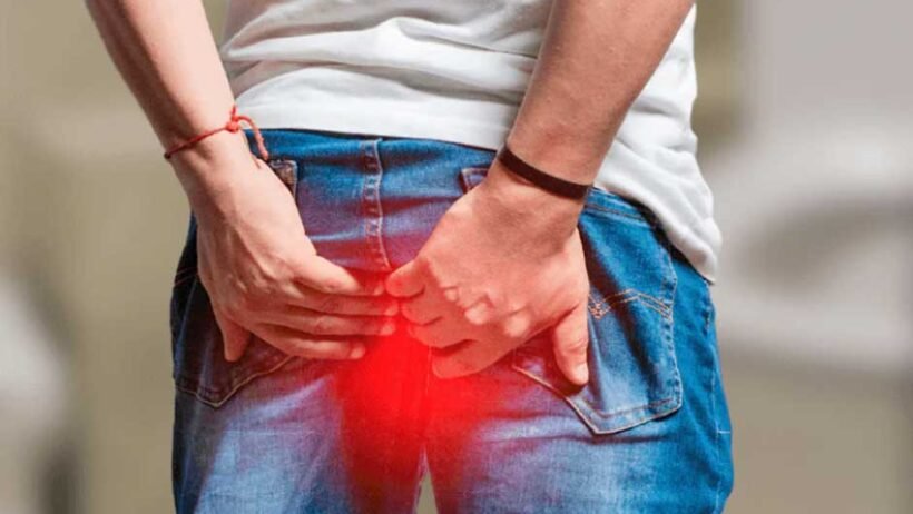 Why Lidocaine-Based Treatments Work Better for Hemorrhoids?